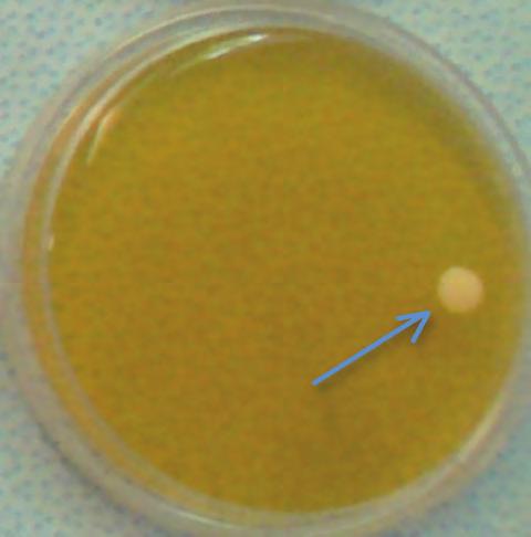 SABourAud + CLorAMFenICOLO AGAR: è un terreno selettivo per l identificazione presuntiva dei lieviti appartenenti al genere Candida species (compreso il lievito patogeno Candida albicans) (Figura 24).