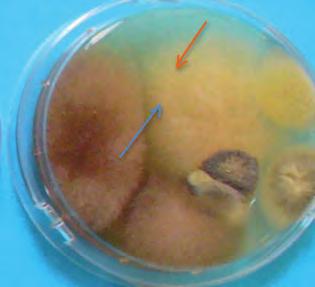 SABOURAUD + CLORAMFENICOLO AGAR: è un terreno selettivo per la crescita dei miceti a base di peptone micologico, che fornisce i fattori di crescita azotati e destrosio (20%), come fonte di carbonio a