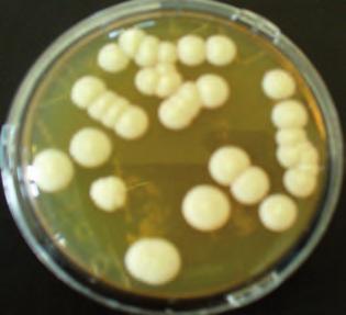 Colonia bianca cremosa: Candida spp. Figura 25 - Rodac con terreno SAB+CLF AGAR. Colonie vellutate per la presenza del micelio fungino aereo di colore diverso colori a seconda della specie fungina.