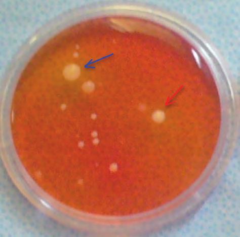 Figura 13 - Rodac con terreno MANNITOL SALT AGAR. Colonie di Stafilococcus coagulasi positiva con alone giallo, presunta colonia di Stafilococcus aureus.