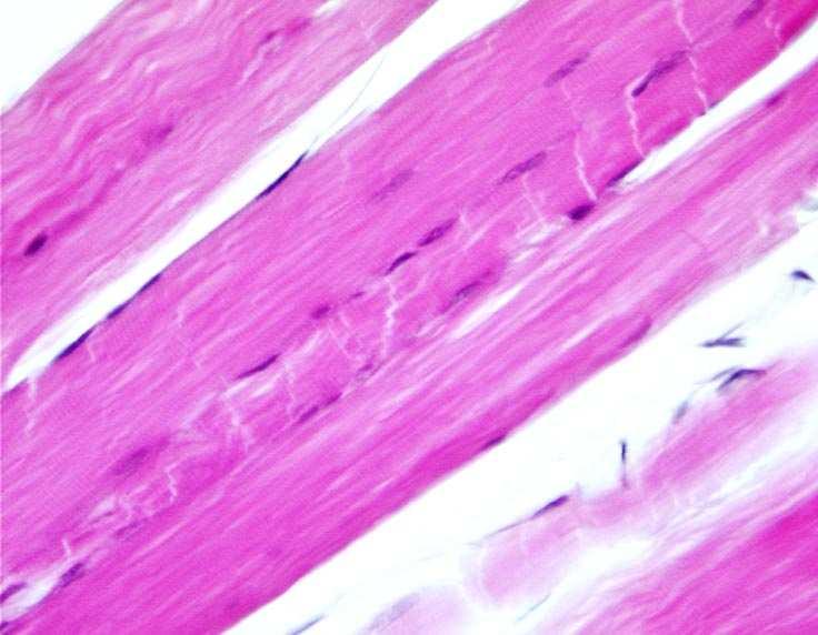 Fibre muscolari scheletriche in sezione longitudinale Sono visibili diversi nuclei ed è appena