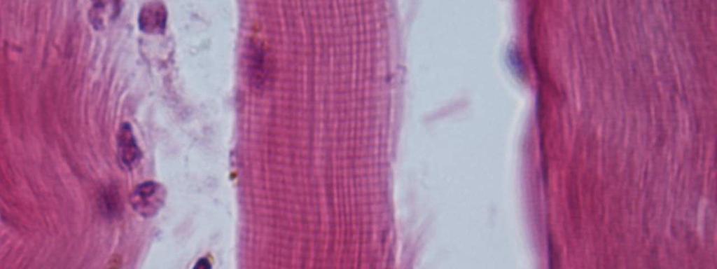 Fibre muscolari striate