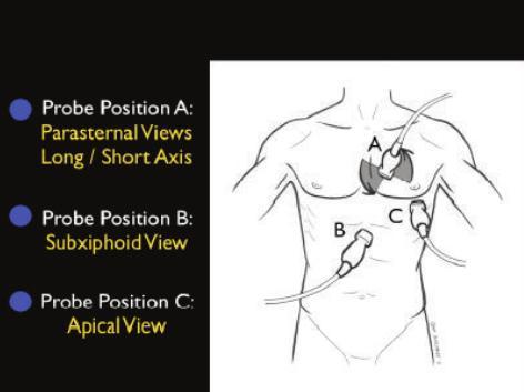 Ma si potrebbe anche fare EchocardioFocus qualunque finestra valida non