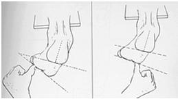 L'escursione articolare a carico dell'articolazione mediotarsica dipende dalla posizione dell'articolazione