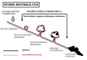 L importanza degli adenomi Iniziale incremento di incidenza (adenomi cancerizzati e