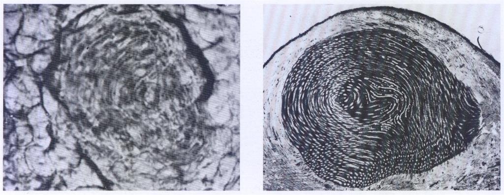 GEMME AVVENTIZIE A sinistra: stadio iniziale del differenziamento di uno sferoblasto in seno ai