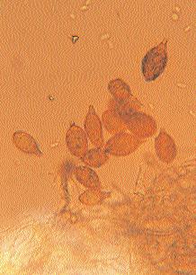 Le spore sono ialine di forma cilindrica con all interno tre guttule, di cui quella centrale molto più grande.