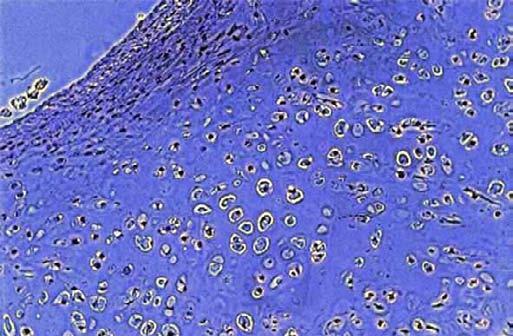 Le grandi ossa lunghe hanno una cavità interna riempita di midollo