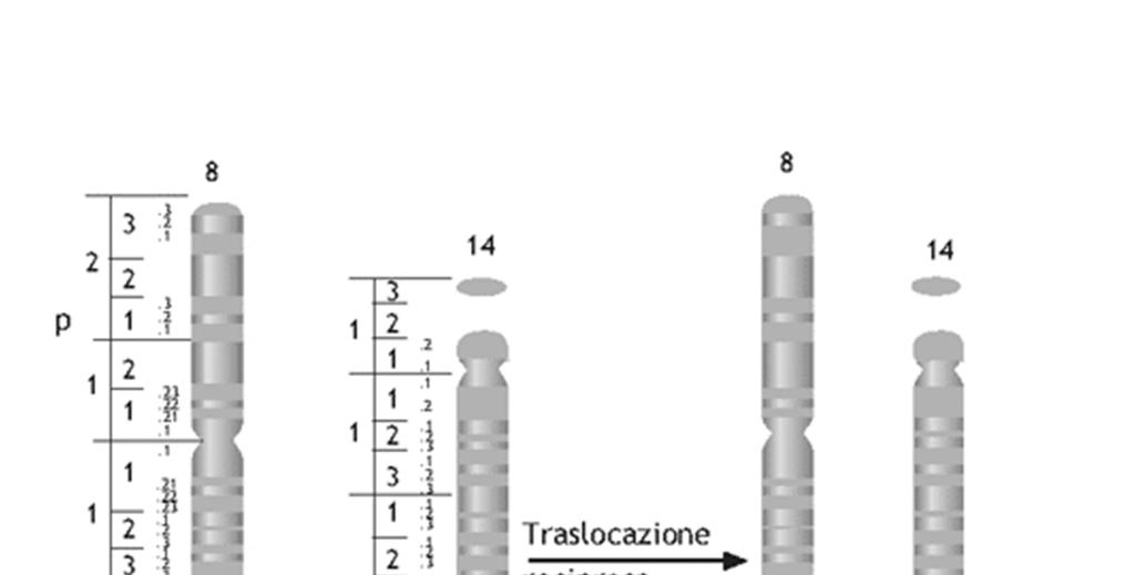 Traslocazione 8-14 sposta proto-oncogene c-myc in regione