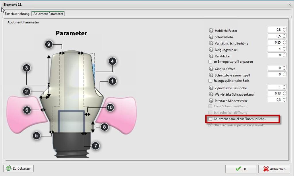 1.4 Moncone personalizzato Moncone parallelo all asse di inserimento All interno dei parametri del