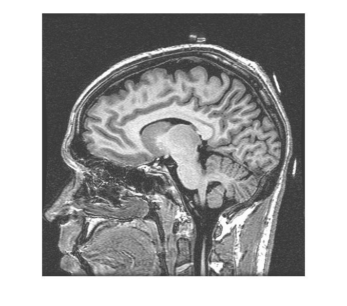 Esempi Immagini di intensità: MRI_Brain.2f Immagine rgb: bosco.jpg Immagine indicizzata: bacio.png Per leggere l immagine si può usare imread I=Imread( MRI_Brain.