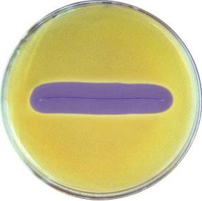 sviluppo e proliferazione dei patogeni associati alle infezioni, Staphilococchi Aureus ed Epidermidis, MRSA e MRSE.