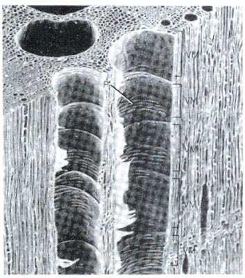 uno su l altro le tracheidi e gli elementi vasali sono cellule morte che non possiedono membrane e