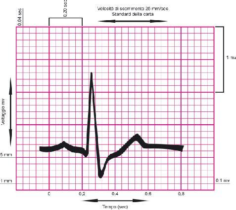 (02.45) INTERPRETARE LE FONDAMENTALI ANOMALIE DI UN TRACCIATO ECG L elettrocardiogramma (ECG) è uno strumento utile per la diagnosi di tutte quelle situazioni che provocano l alterazione dell