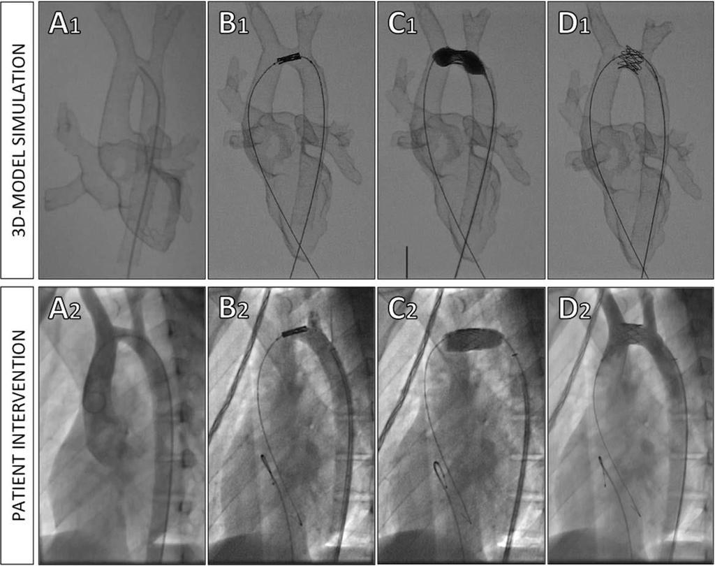 trasparente, lucido), Filaflex (flessibile, opaco) Uso del modello flessibile per la simulazione dell