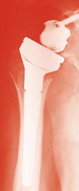 Cartilagine e Tecnologie Ortopediche