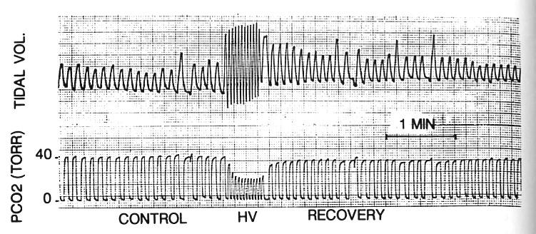 2. Short - term potentiation Associato agli stimoli che causano l aumento della ventilazione, esiste un meccanismo neurale centrale intrinseco localizzato nel ponte e nel midollo allungato che