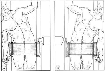 radiografico Fig. 3-240 pag.