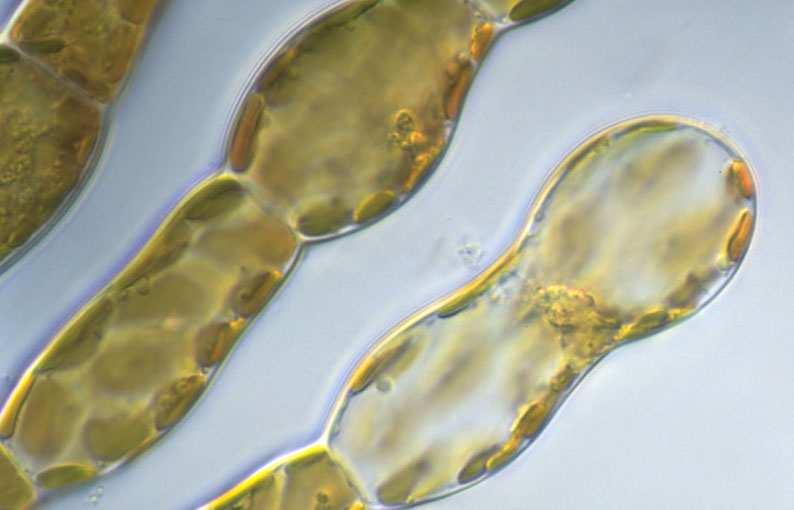 I cromatofori delle alghe brune