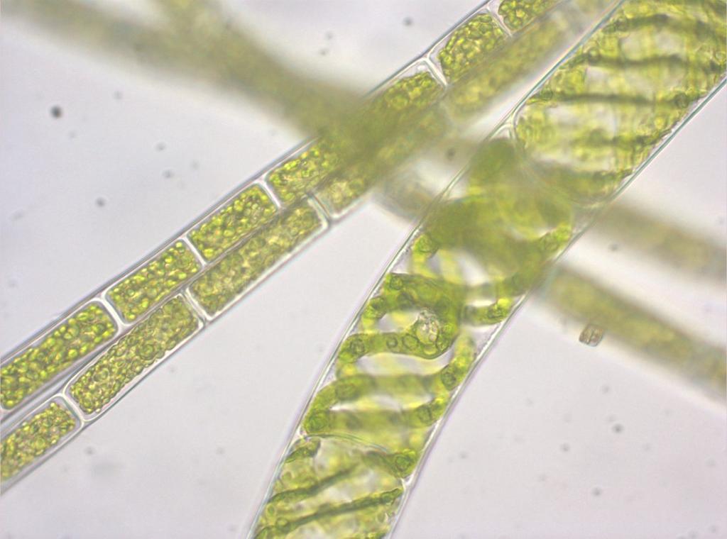 Nei cloroplasti delle alghe si trovano solitamente uno o più pirenoidi (Foto Fattorini L.