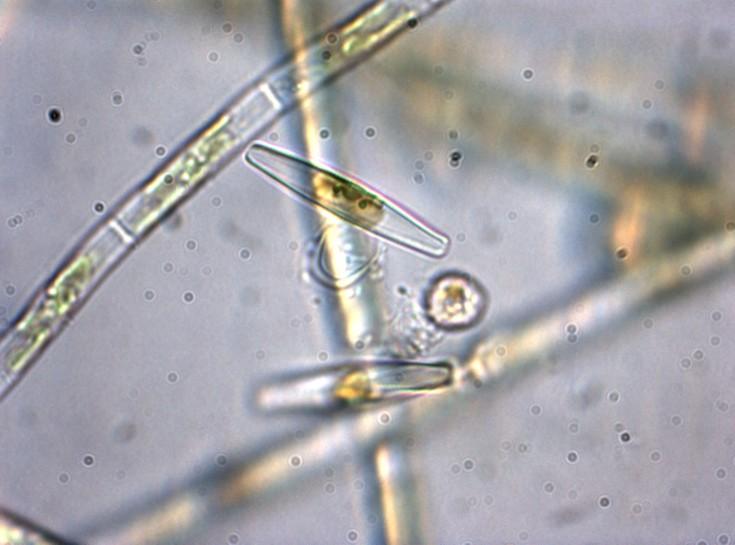 interno del protoplasto sono plastidi bruni (colore dovuto alla fucoxantina, un