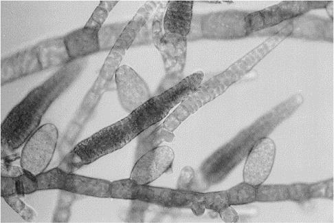 Tallo con organizzazione tricale ramificata * * * * Ectocarpus: (alga bruna) lo sporofito ha sporocisti uniloculari (*) che contengono le meiospore e