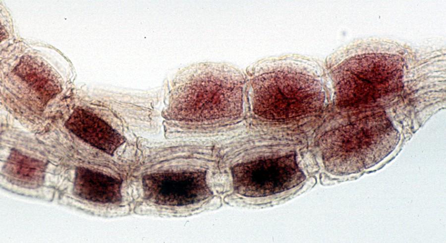 A tallo pseudoparenchimatico Polysiphonia (alga rossa