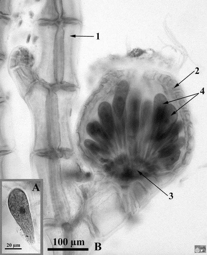 Carposporofito di Polysiphonia Dopo la fecondazione, lo zigote origina un carposporofito (2n), al cui interno si formano carposporocisti e carpospore (2n),