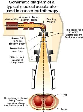 Medicina: Radioterapia Radiazione su cellule tumorali: molto