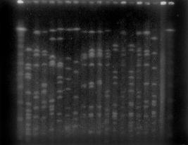 m AB CDEFG H I L M m m N m Figura 1 - Principali profili elettroforetici (PFGE) indicati con le lettere da A ad N di 36 S. aureus MR intermedi alla vancomicina dopo trattamento in vitro.