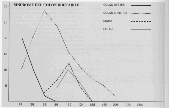 Sindrome del colon irritabile Il rallentamento del transito del colon di sinistra è evidenziato dalla