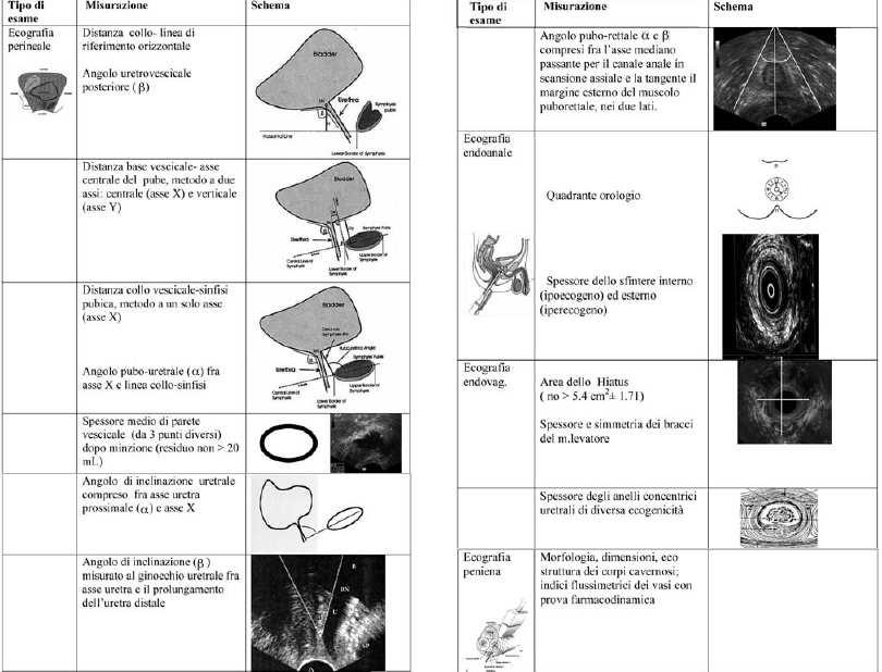 Ecografia Clinica Esame Appropriatezza Incontinenza fecale Eco endoanale 9 RM 8 Defeco RX 6 Esterna (perineale intritale, peniena) Interna (endoanale, endovaginale) Incontinenza urinaria Prolasso