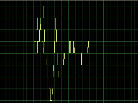 5 - Definizione delle problematiche arrivo dello stesso all accelerometro e, di conseguenza, di rilevare il tempo di volo dell onda; Pulsante 2: Permette all operatore di eseguire alcuni tipi di