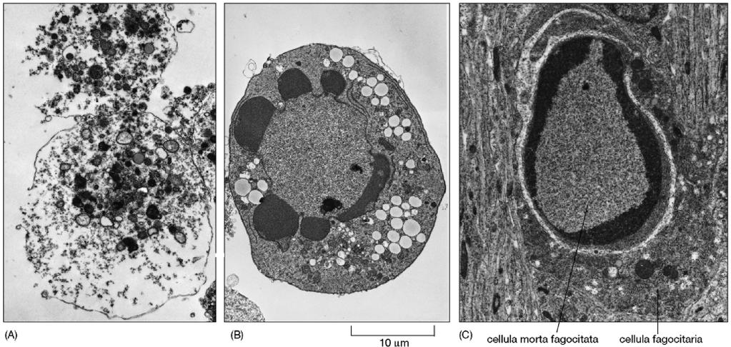 La cellula in apoptosi muore in modo rapido e pulito, si restringe e si addensa il suo citoscheletro collassa la membrana nucleare si dissolve ed il DNA nucleare si frammenta (così facendo il