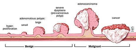 ONCOGENESI FATTORI DIETETICI FATTORI