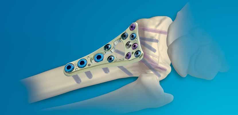 TECNICA OPERATORIA Contours