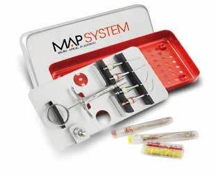 Map System Per il posizionamento dei materiali da otturazione endodontici I kit e i puntali MAP SYSTEM sono adatti all'applicazione di ProRoot MTA INTRO KIT NiTi per otturazione ortograda (Intro Kit