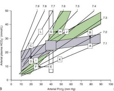 I meccanismi di compenso dell insufficienza respiratoria e loro ricadute funzionali Location in Figure 7-3 Metabolic Parameter (meq/l) ph Respiratory Parameter Pco 2 (mm Hg) Normal range 23 27 7.38 7.