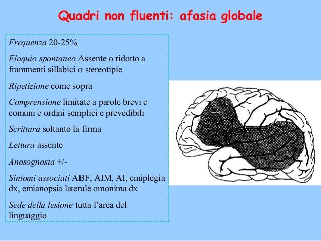 Afasia Globale Incapacità completa e totale di parlare e comprendere il linguaggio.