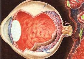 in Patients ts with Type 2