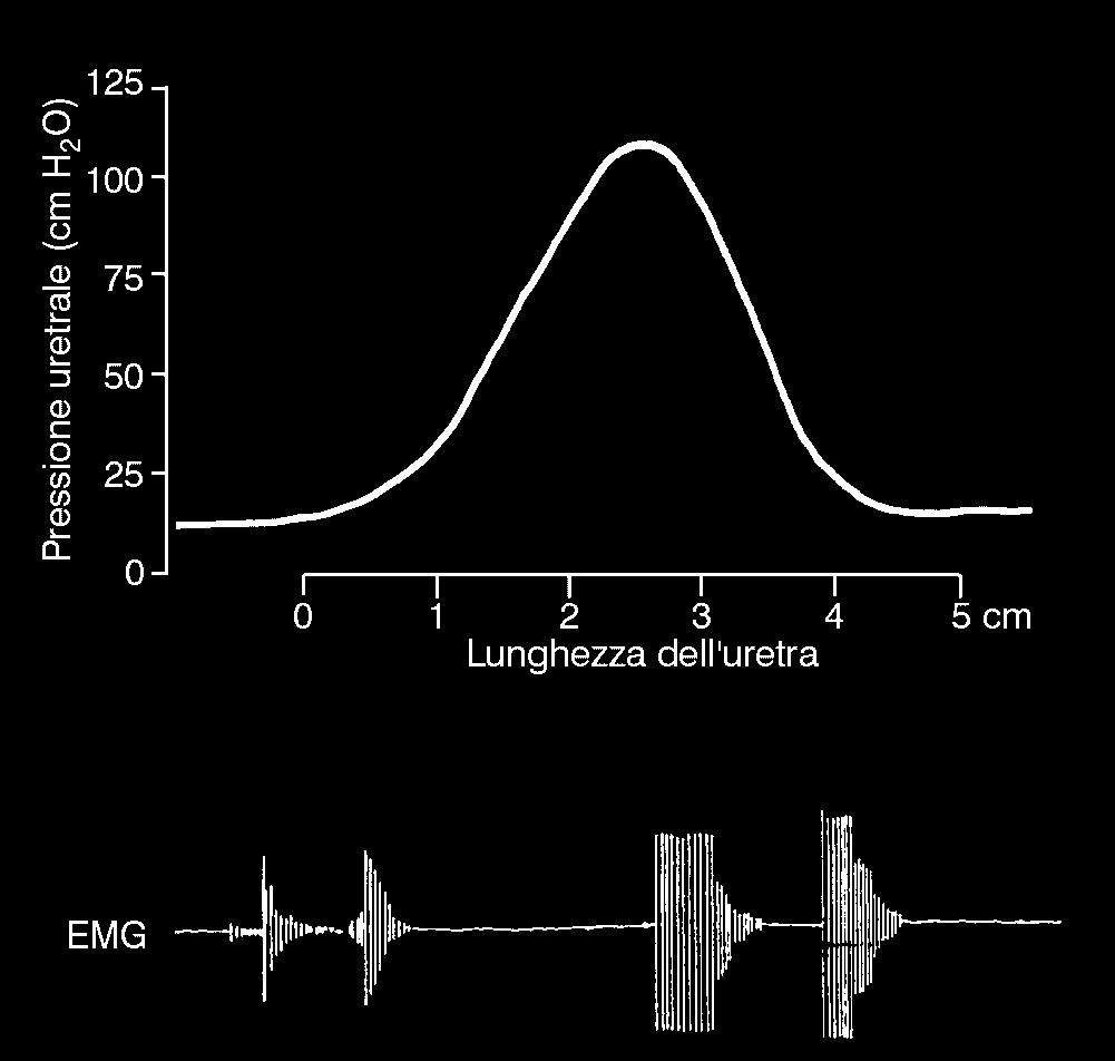 Si nota che l'attività dello sfintere striato è massima dopo il punto di massima pressione di chiusura uretrale. Modificata da (16).