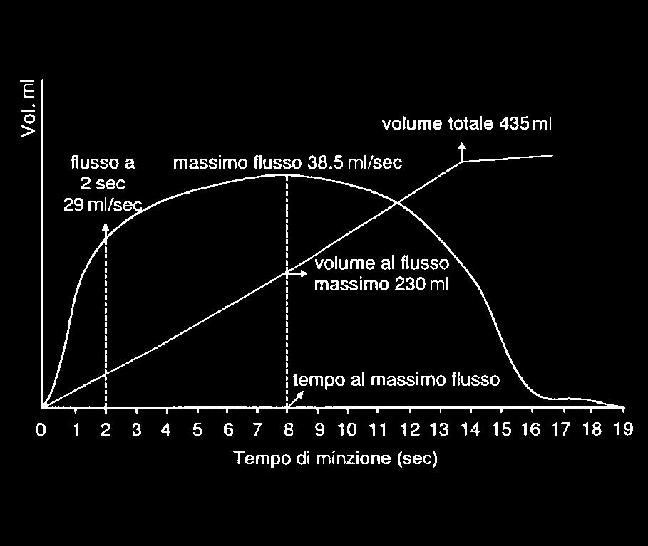 Figura 14 Registrazione grafica della misura del flusso urinario espresso in volume per unità