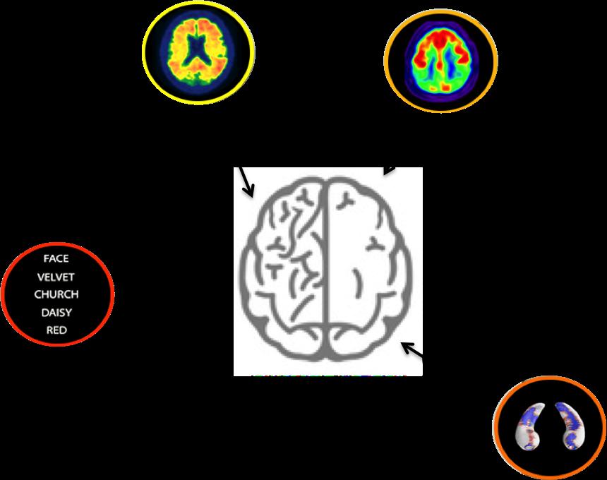 Dall accademia alla clinica Alzheimer Approcci combinati con tecniche diverse