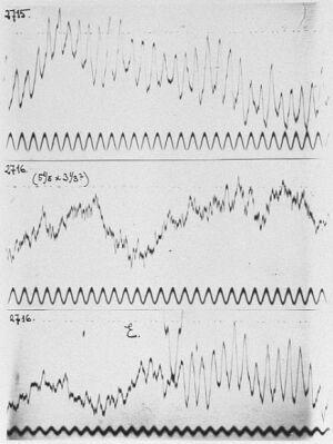 Inizialmente, l EEG è stato utilizzato come ausilio nelle diagnosi di determinate condizioni neurologiche (epilessia), successivamente anche per