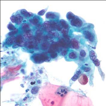 Ricordando quindi che questa diagnosi funzionale non è la DIAGNOSI CLINICA I Biologi presentarono dei ricorsi alla magistratura amministrativa nei due livelli di giudizio ( T.A.R. e Consiglio di Stato ).