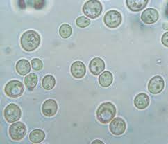 7) Il lievito [18] Osservi l immagine del lievito visto al microscopio ottico.
