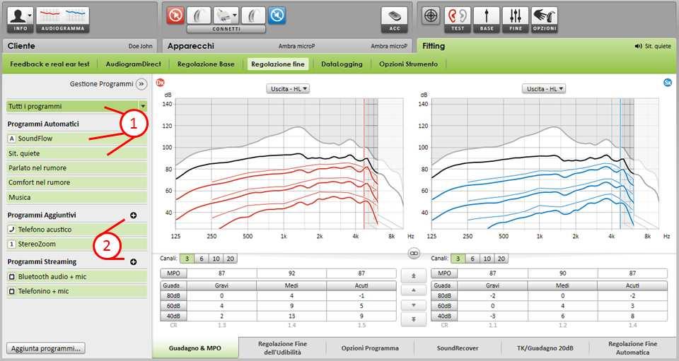 Questa opzione rende le impostazioni di compressione più lineari rispetto a quelle consigliate nella formula di fitting selezionata, per facilitare la transizione dall'elaborazione del segnale