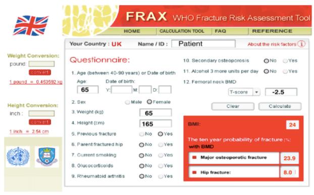 Il FRAX dal 2008 Algoritmo approvato dall Organizzazione Mondiale della Sanità, che stima il rischio assoluto di frattura a 10 anni, sulla base dell analisi di diverse variabili in grado di