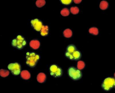 Cellule di linfoma trattate con il chemioterapico Camptothecin ESPOSIZIONE DI FOSFATIDIL-SERINA