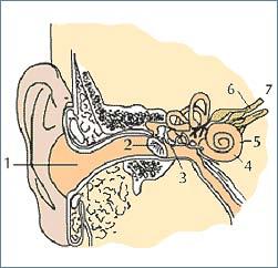 (1) Il suono attraversa il canale uditivo e colpisce il timpano.